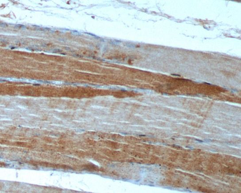 ULK1 Rabbit Polyclonal Antibody