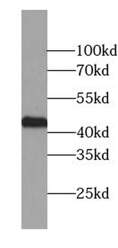 UPB1 Rabbit Polyclonal Antibody