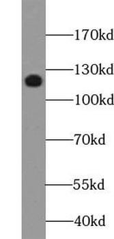 UPF1 Rabbit Polyclonal Antibody