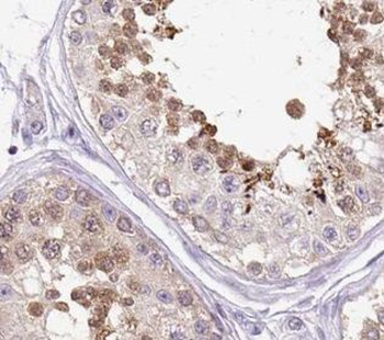 UPF3B Rabbit Polyclonal Antibody