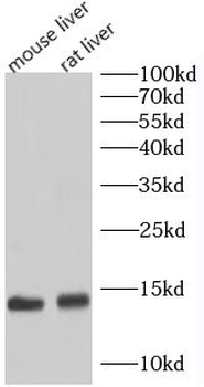 UQCRB Rabbit Polyclonal Antibody