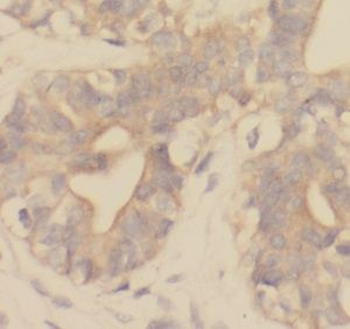 UQCRB Rabbit Polyclonal Antibody