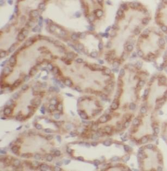 UQCRFS1 Rabbit Polyclonal Antibody