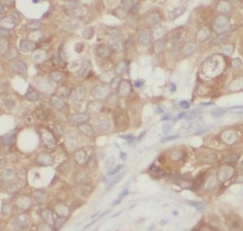 UQCRH Rabbit Polyclonal Antibody