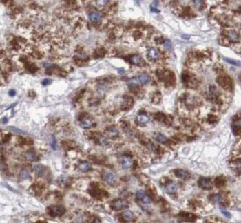UQCRQ Rabbit Polyclonal Antibody