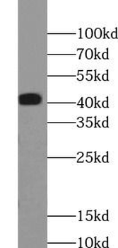 SLC22A12 Rabbit Polyclonal Antibody