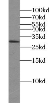 UROS Rabbit Polyclonal Antibody
