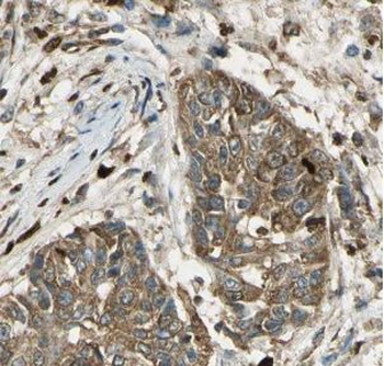 UROS Rabbit Polyclonal Antibody