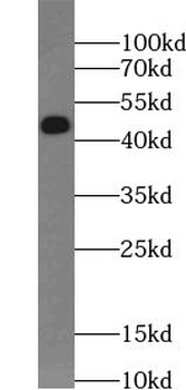USF2 Rabbit Polyclonal Antibody