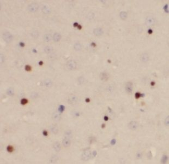 USP11 Rabbit Polyclonal Antibody