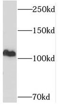USP11 Rabbit Polyclonal Antibody