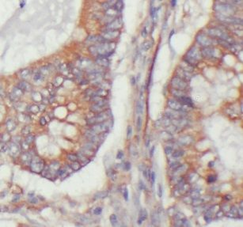 USP11 Rabbit Polyclonal Antibody
