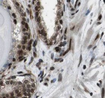 USP13 Rabbit Polyclonal Antibody