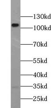 USP15 Rabbit Polyclonal Antibody