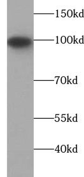 USP16 Rabbit Polyclonal Antibody
