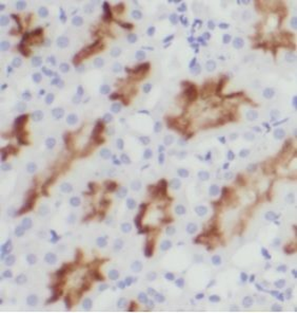 USP16 Rabbit Polyclonal Antibody