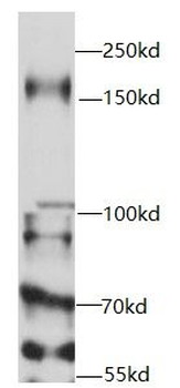 USP19 Rabbit Polyclonal Antibody
