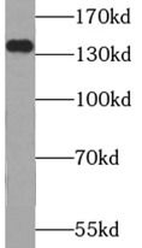 USP25 Rabbit Polyclonal Antibody