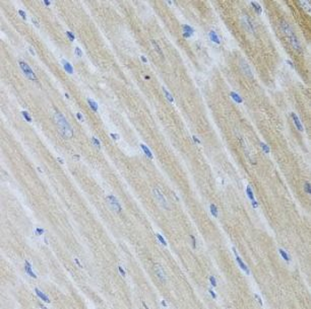 USP25 Rabbit Polyclonal Antibody