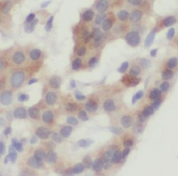USP32 Antibody