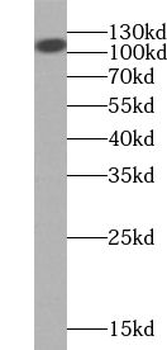 USP33 Rabbit Polyclonal Antibody