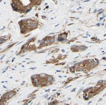 USP33 Rabbit Polyclonal Antibody
