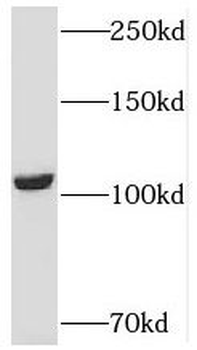USP33 Rabbit Polyclonal Antibody