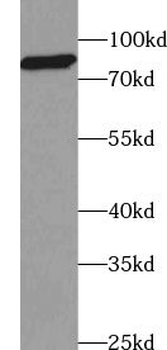 USP35 Rabbit Polyclonal Antibody