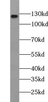 USP36 Rabbit Polyclonal Antibody
