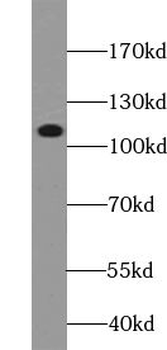 USP37 Rabbit Polyclonal Antibody