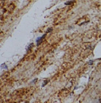 USP38 Rabbit Polyclonal Antibody