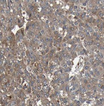 USP48 Rabbit Polyclonal Antibody
