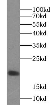 VAMP4 Rabbit Polyclonal Antibody