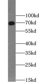 VANGL2 Rabbit Polyclonal Antibody