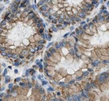 VANGL2 Rabbit Polyclonal Antibody