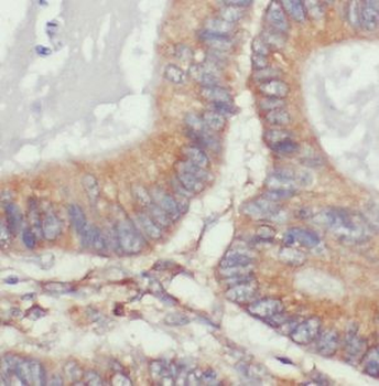 VAPA Rabbit Polyclonal Antibody