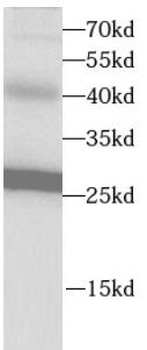 VAPB Antibody