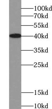 VASH2 Rabbit Polyclonal Antibody