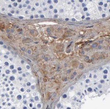 VASP Rabbit Polyclonal Antibody