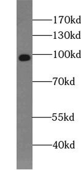 VAV1 Rabbit Polyclonal Antibody