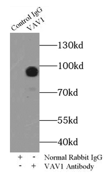 VAV1 Rabbit Polyclonal Antibody