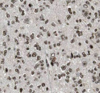VCP Mouse Monoclonal Antibody