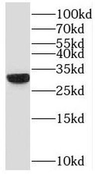 VDAC3 Antibody