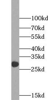 VDAC3 Rabbit Polyclonal Antibody