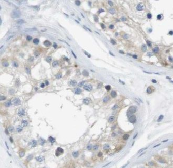 VDAC3 Rabbit Polyclonal Antibody