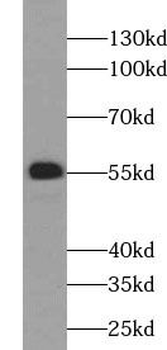 SLC32A1 Rabbit Polyclonal Antibody