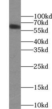 SLC17A6 Rabbit Polyclonal Antibody