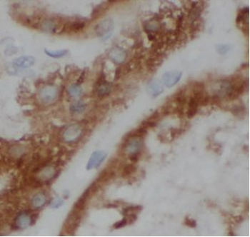 VHL Antibody