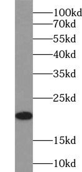 VSNL1 Rabbit Polyclonal Antibody