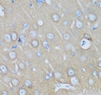 VSNL1 Rabbit Polyclonal Antibody